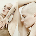 Sobreviviendo al cáncer