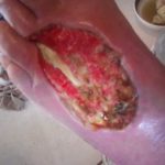 Imparables ataques de «violinista»