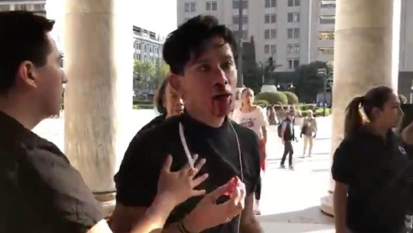 golpean-joven-bellas-artes