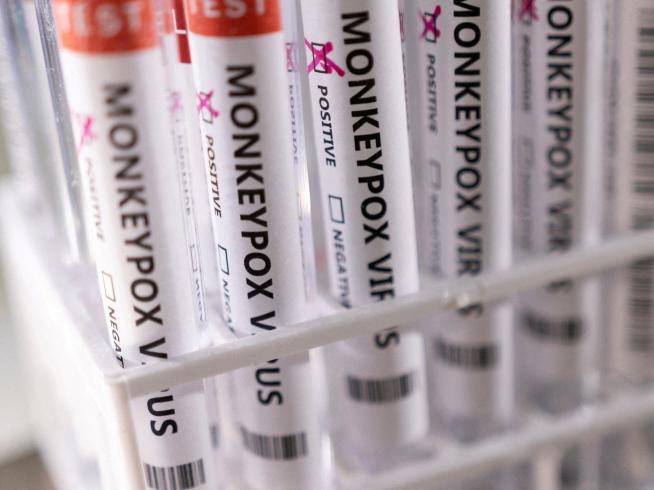 muestras-de-laboratorio-de-casos-de-viruela-del-mono