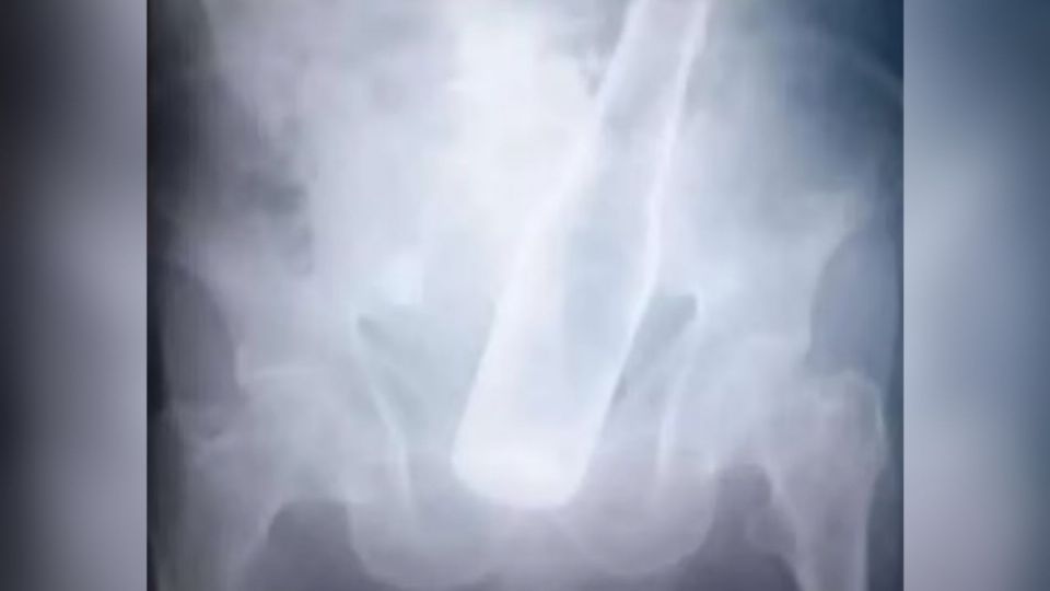 f960x540-623459_697534_15